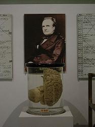 Charles Babbage's brain